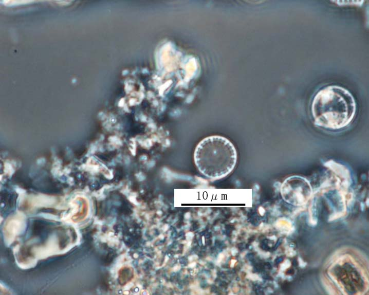 珪藻綱　Cyclotella atomus